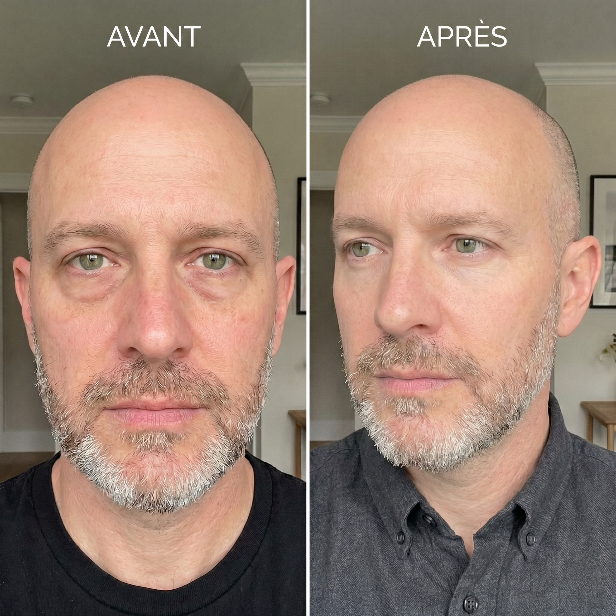 04 before after face fr